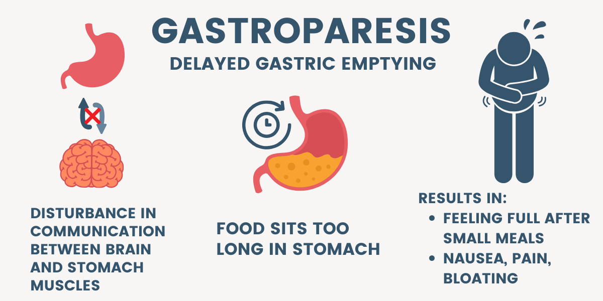  illustration showing steps to delayed gastric emptying