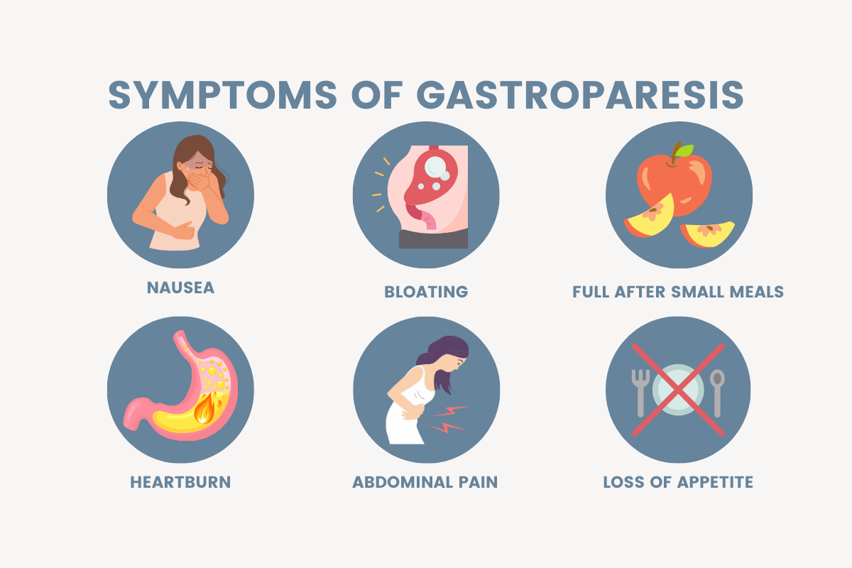  illustration of 6 common symptoms of gastroparesis