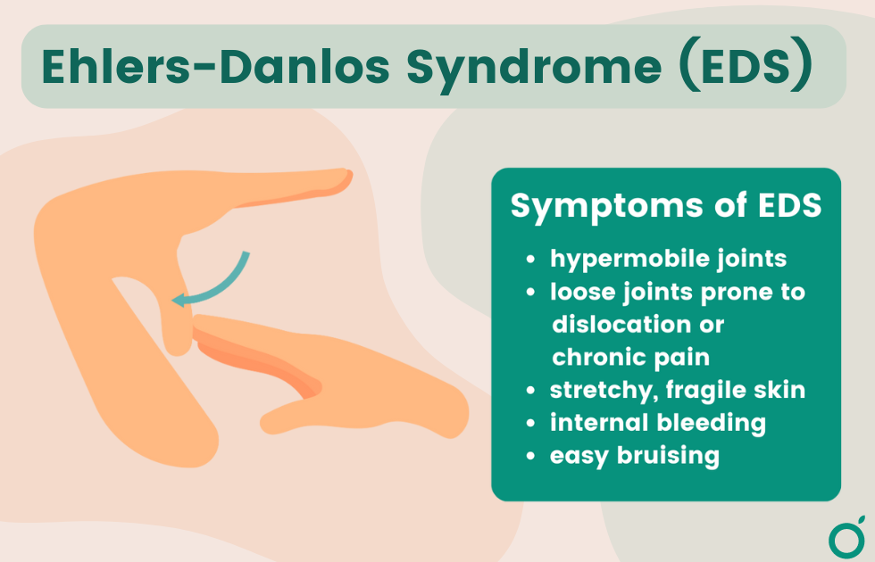 graphic explaining ehlers danlos syndrome