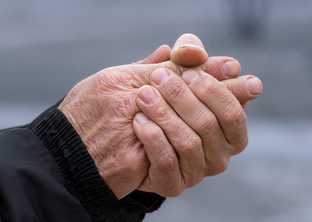 Battling winter skin woes? 9 ways to avoid dryness and irritation