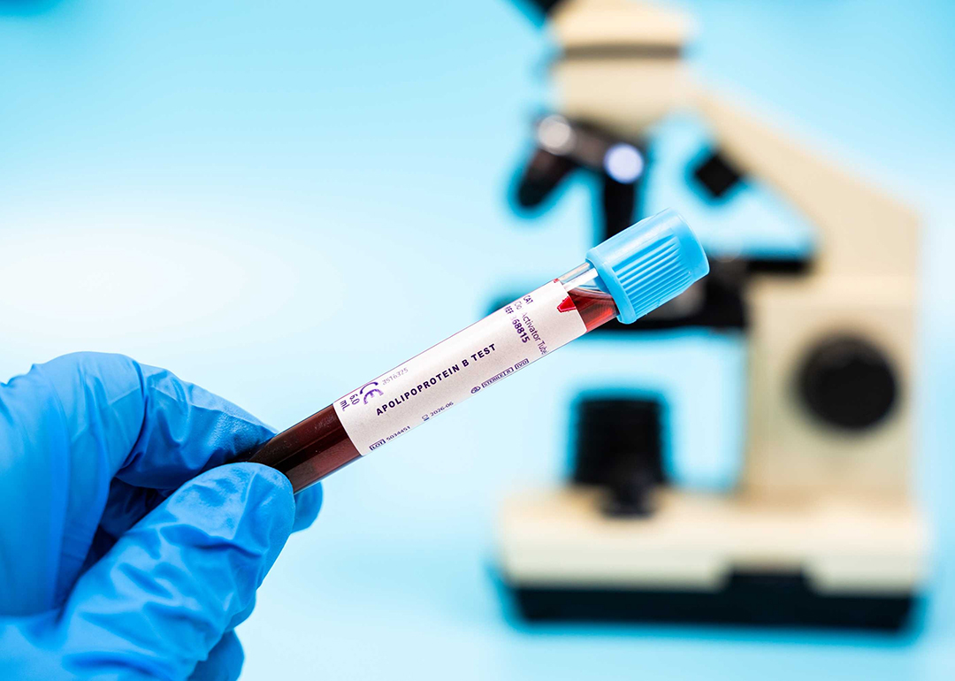 This heart health test spots risks better than cholesterol