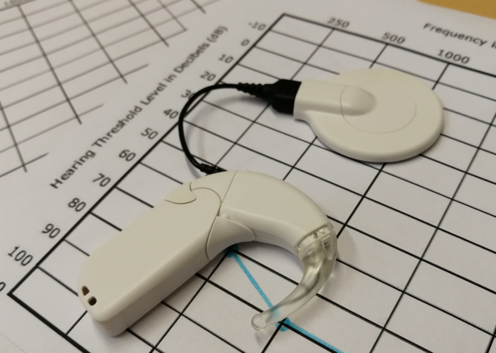 Cochlear implant on hearing test.