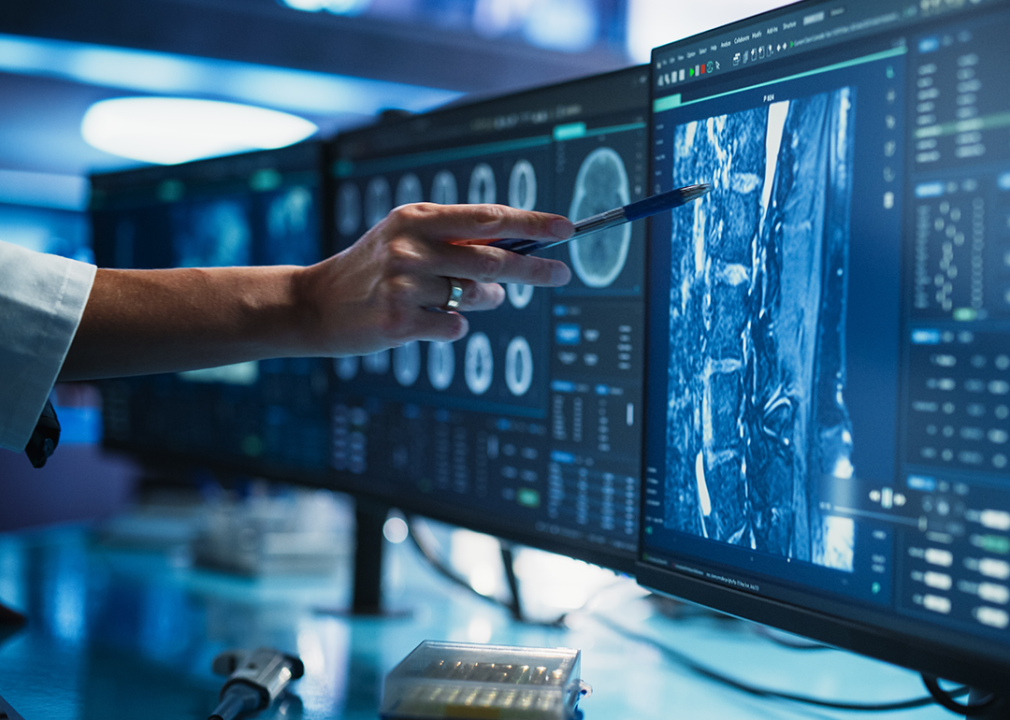 Person pointing to monitor with results from a CT scan.