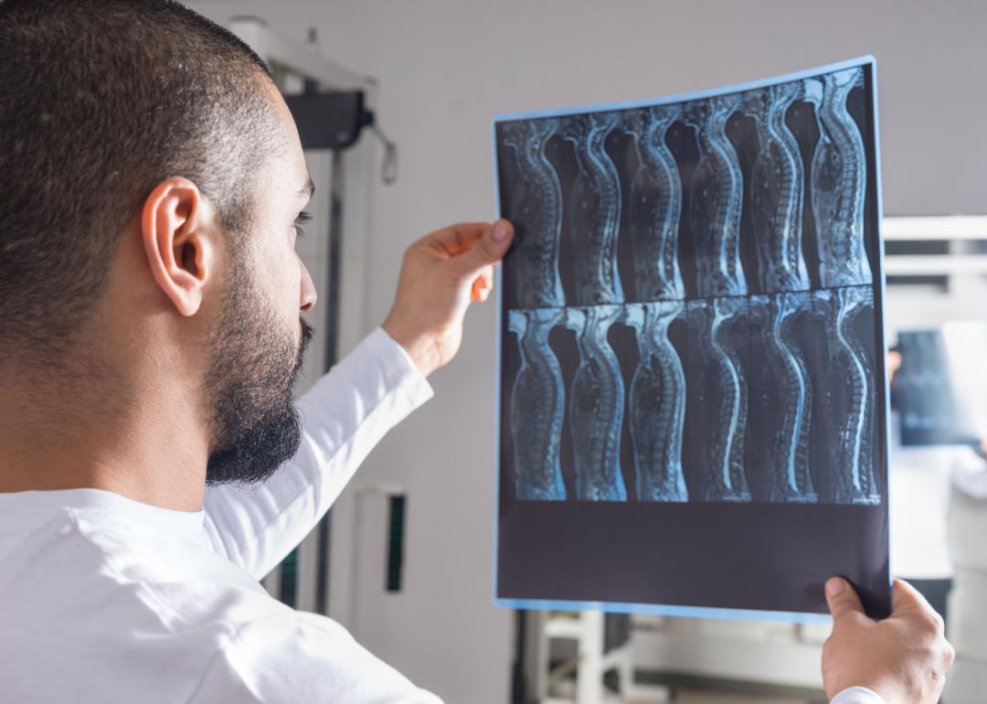 Radiologist reviewing spine X-ray.
