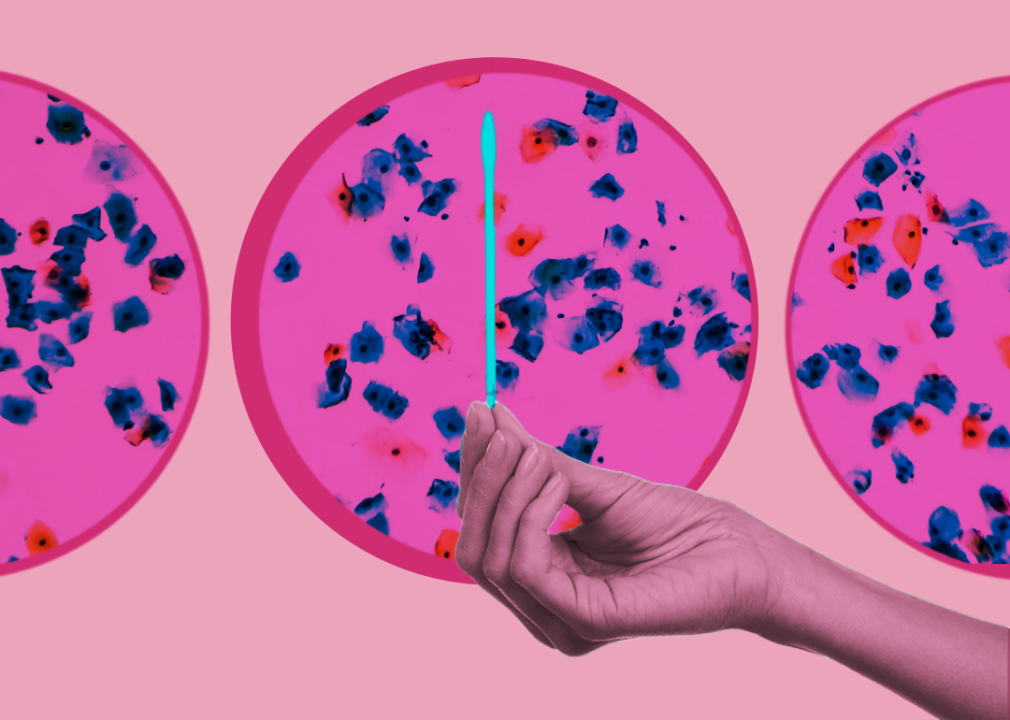 Hand holding test swab with pap test cells in background.