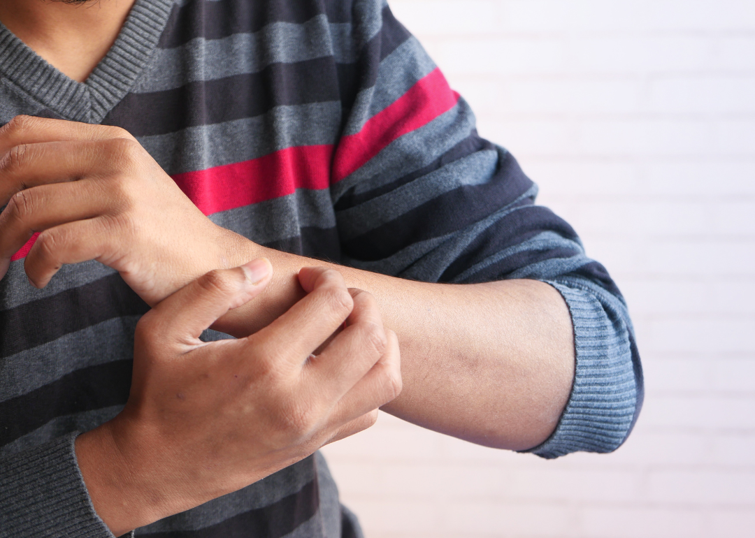 Close-up of man scratching his arm.