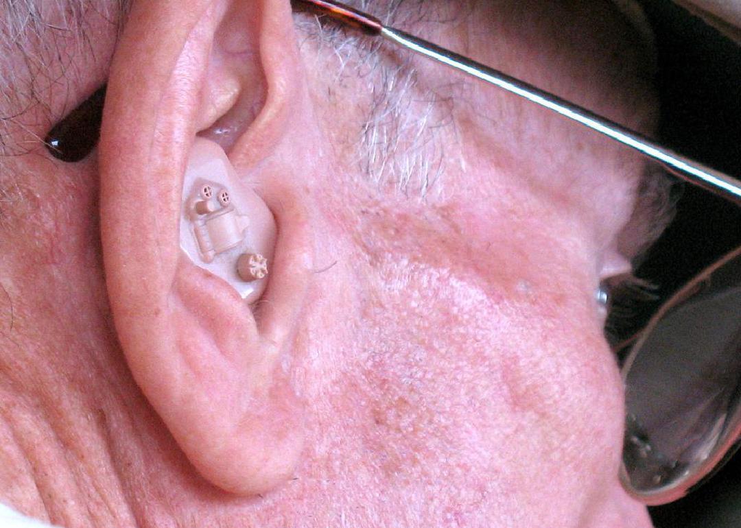 A close up of an elderly man's ear with a heading aid device in place. 