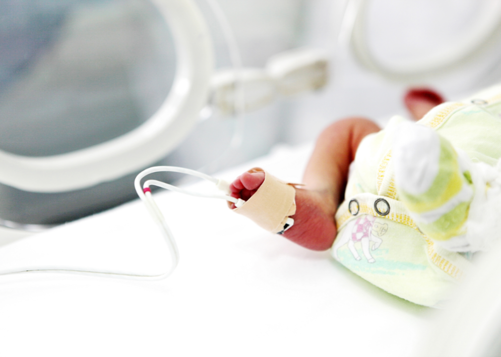 A baby in an incubator.