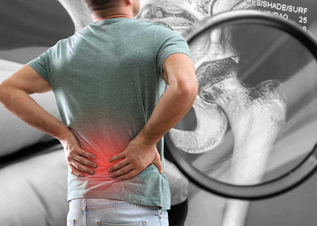 Photo illustration of a man experiencing back pain against a background of a black and white X-ray.