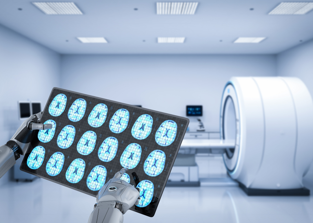 A robot holding a brain scan.