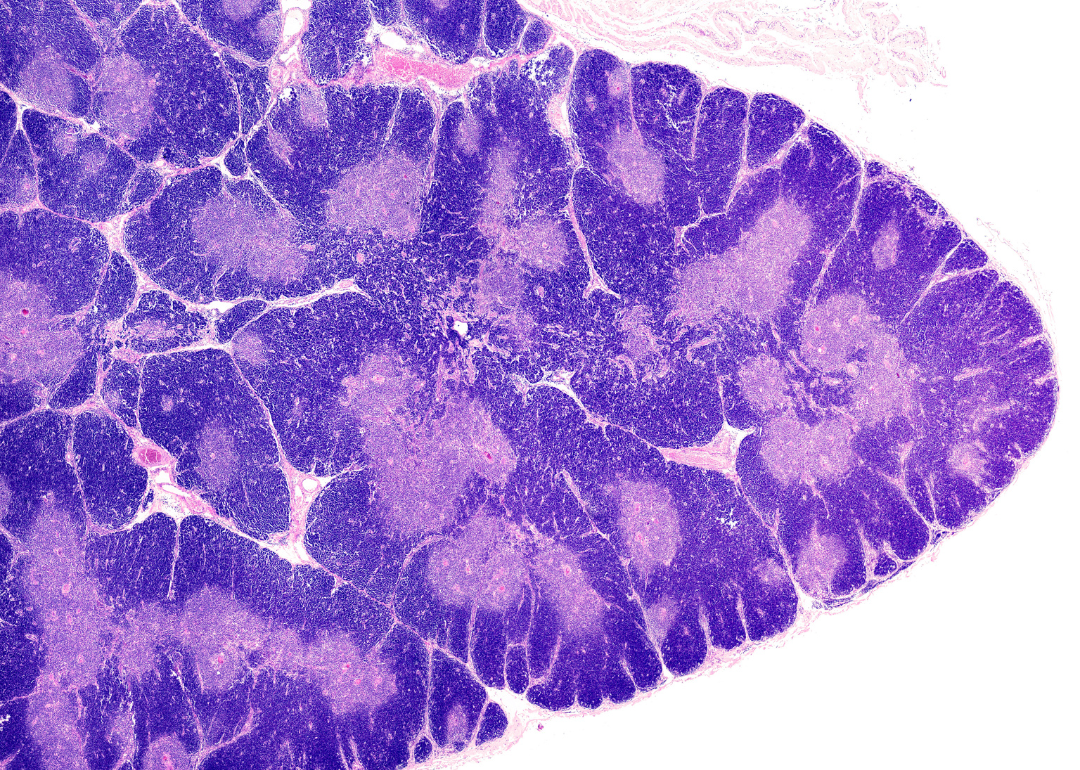 A very low magnification light microscope micrograph of a thymus gland stained with HE.