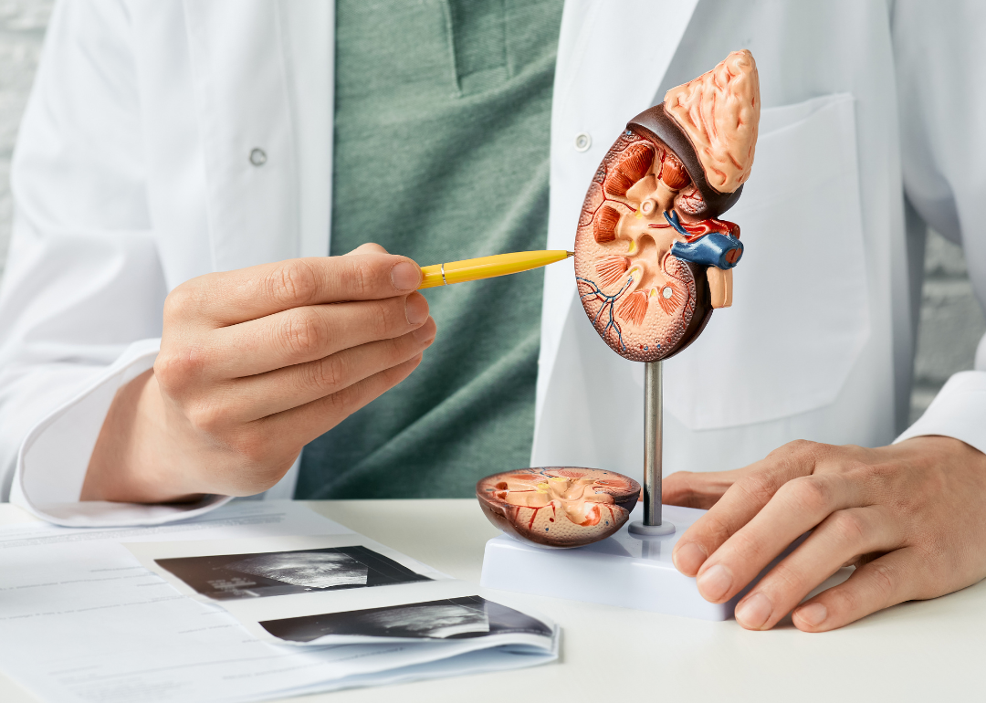 A doctor pointing to an anatomical model of a kidney.