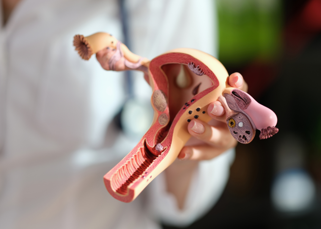 A diagram of the female reproductive system.