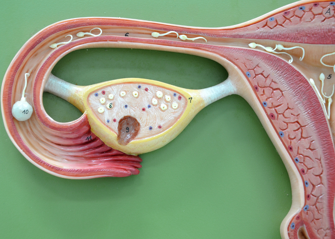 A model of a uterus with sperm moving through the fallopian tubes.