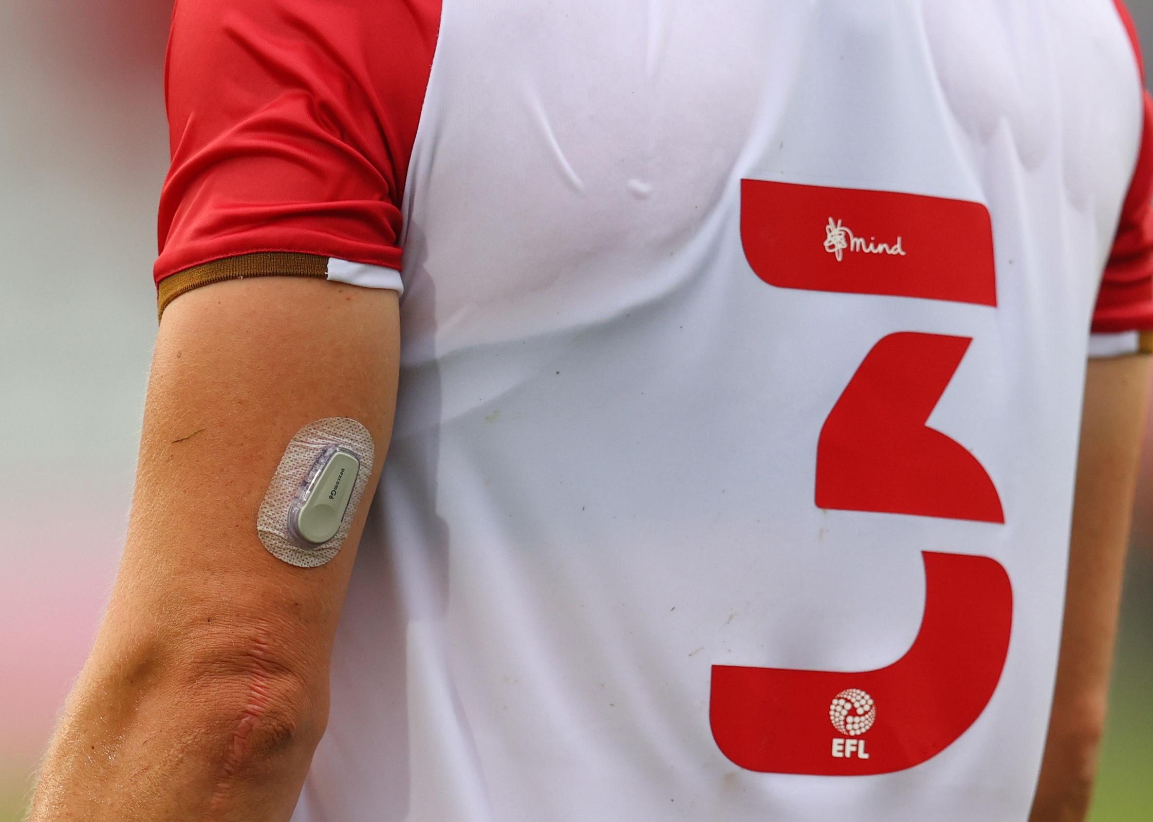 Detailed view of a player with a Dexcom g6 glucose monitoring system.