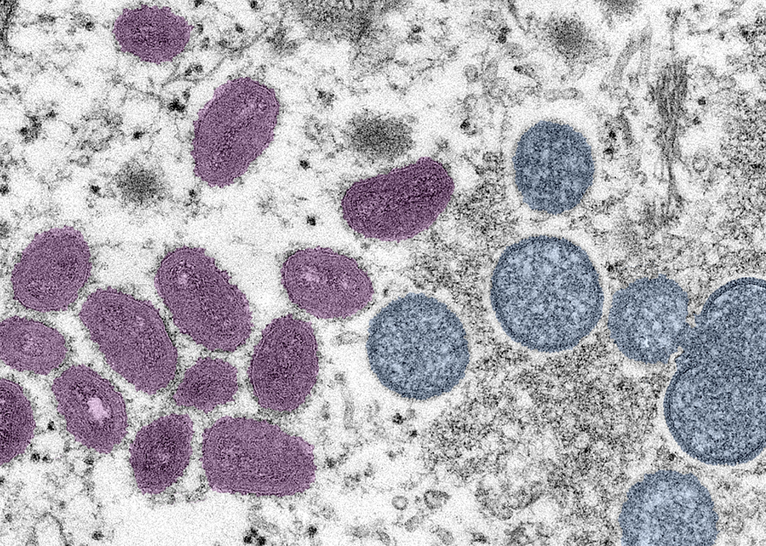 A digitally-colorized electron microscopic (EM) image depicting a Monkeypox virion (virus particle),