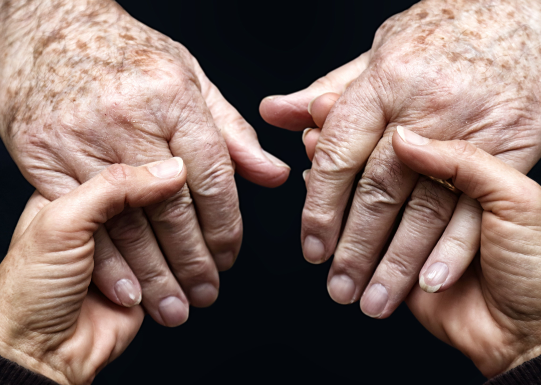 Two younger hands holding two older hands.