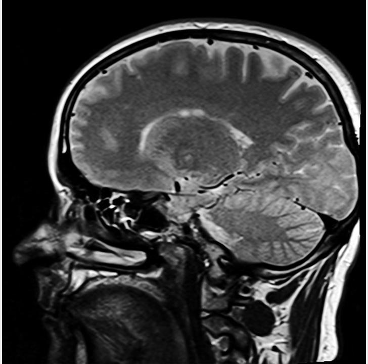 30 Popular Science Myths Debunked » head 254863 960 720