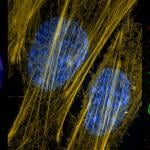 Composite of three mages from new microscope technology show a cell's replication machinery in green, already-replicated DNA is red and DNA bundled into chromatin in blue. At center, the cytoskeleton’s actin fibers in mouse connective tissue cells are seen in yellow; cellular DNA is stained blue. At right is a human cell dividing in two with its genetic material labeled in red, and the spindle apparatus that pulls the sister chromatids apart labeled in green.