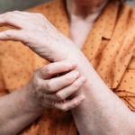 An elderly woman's hands experiencing pains.