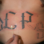 A close-up image of a person's hand using a cotton swab to apply ointment to a partially removed tattoo on the stomach of a man. The letters Y, E, R, and S are in view with part of the R and S removed. 