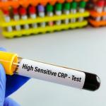 A blood sample tube for hs-CRP (high-sensitive CRP) test.