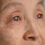 Close up on an elderly woman's eyes with cataracts.