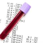 A blood sample over a CBC report document.