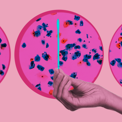 Hand holding test swab with pap test cells in background.