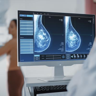 An adult woman undergoing a mammography procedure.