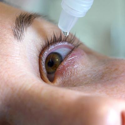 Closeup on the eyes of a woman instilled with a treatment.