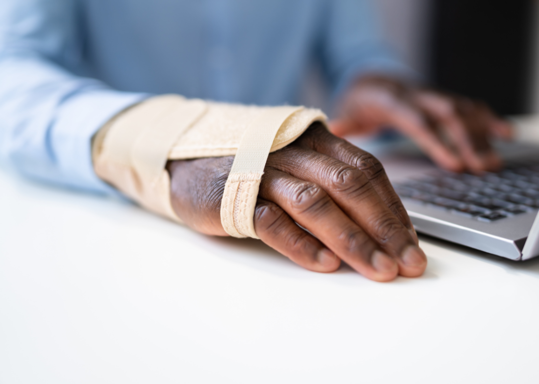 A worker with a broken wrist in a splint typing on their laptop.