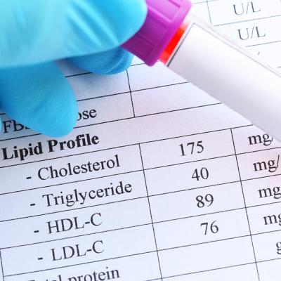 A blood sample in a test tube tube held in front of a printout of lipid profile test results. 