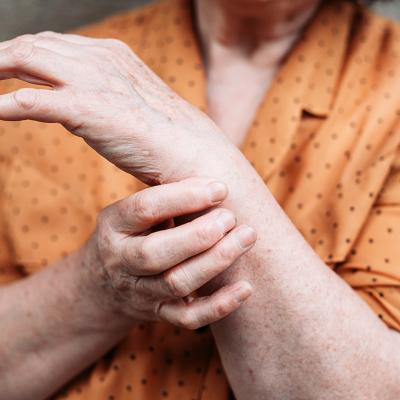 An elderly woman's hands experiencing pains.
