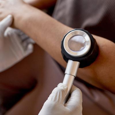 A doctor holds a dermatoscope over a patient's skin to examine for skin cancer.