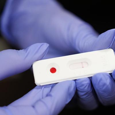 Dr. Ana Davie shows what a negative test for congenital syphilis looks like in just ten minutes at Memorial Hermann - TMC on Wednesday, June 12, 2024 in Houston.