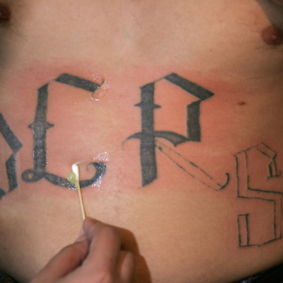 A close-up image of a person's hand using a cotton swab to apply ointment to a partially removed tattoo on the stomach of a man. The letters Y, E, R, and S are in view with part of the R and S removed. 