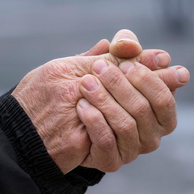 A senior person's hands drying out due to cold weather.