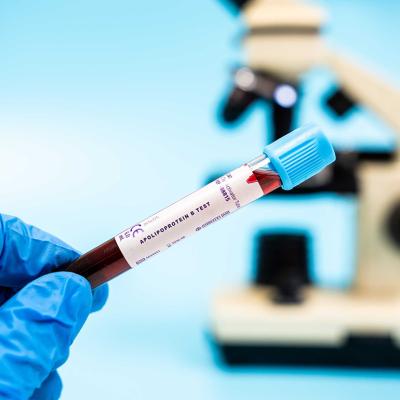 A blood sample labelled for an Apolipoprotein B test.