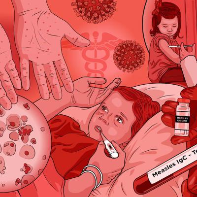 A custom illustration featuring children surrounded by graphics of the Michigan measles outbreak.