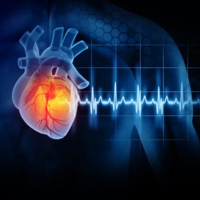 A 3D illustration of a heart attack disease. 