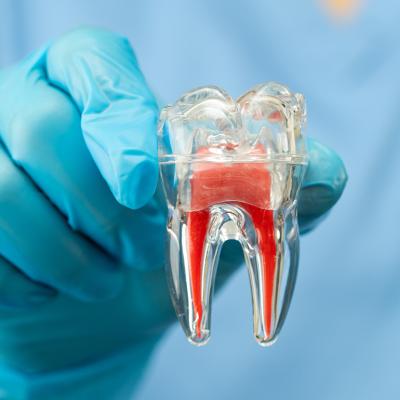 A dentist holding a dental implant model of a tooth.