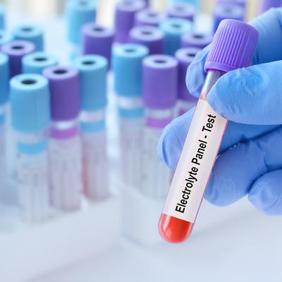 A blood sample tube with an electrolyte panel test label.