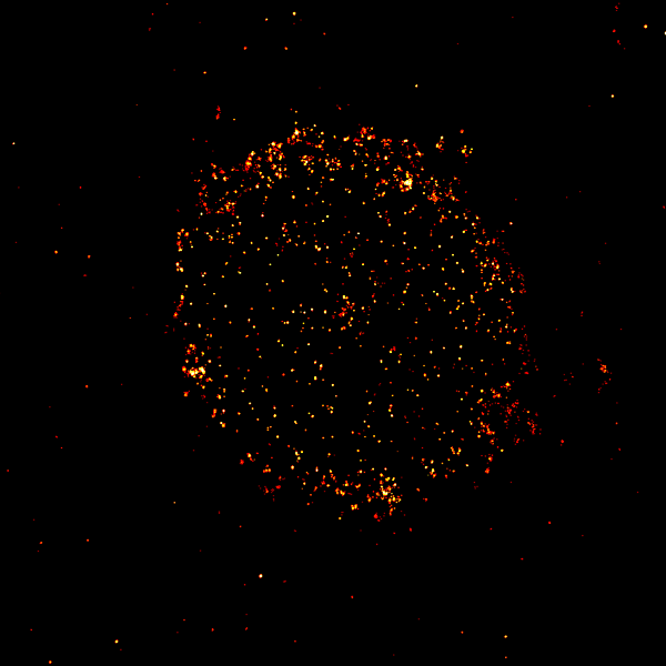 A new microscopy technique can light up the protein CD-19 on the surface of cancer cells which can help determine which patients could benefit from CD-19-targeting therapies.