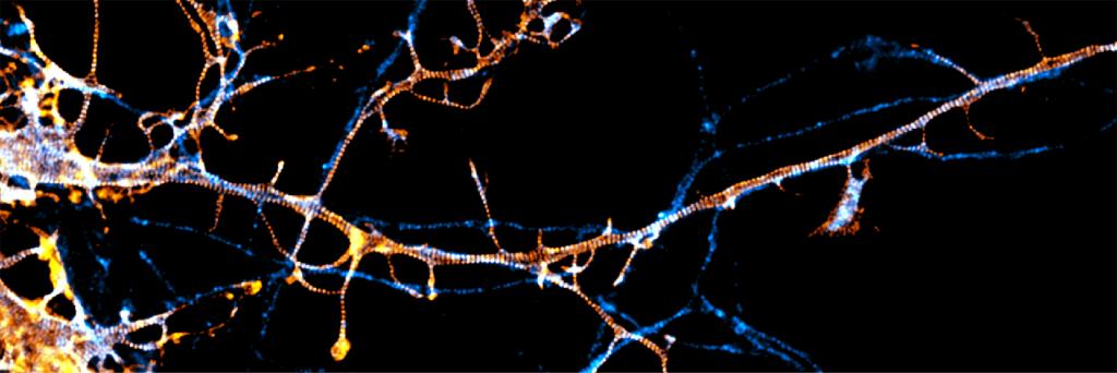 Specialized microscopy techniques have revealed that nerve cells have a special type of internal skeleton called the membrane-associated periodic skeleton, regulated by a protein called parallemin-1 (fluorescently labeled in this image).