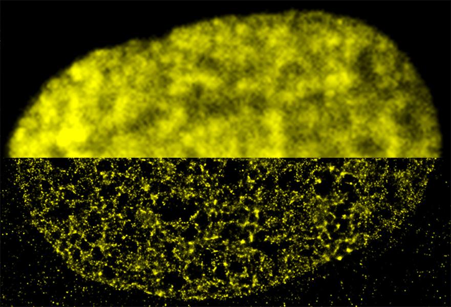 A composite of two images shows technological advances: the top half was imaged with conventional wide-field fluorescence microscopy; the bottom half was imaged with super-resolution microscopy.  Within a fibroblast cell nucleus, the DNA-binding histone protein called H2B is fluorescently labeled in yellow. 