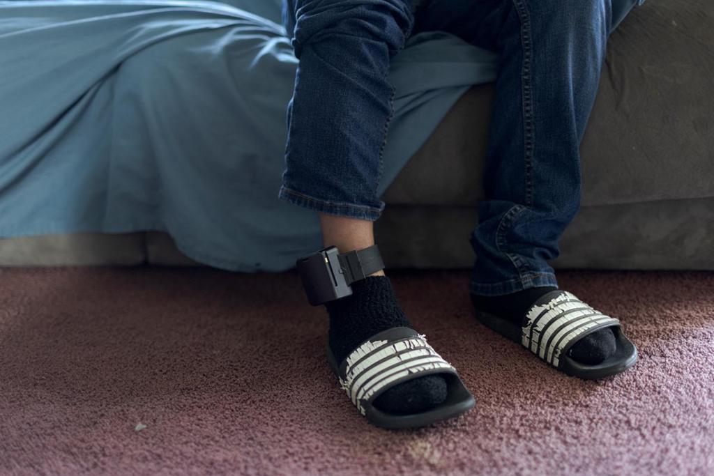 José Edilberto Molina-Aguilar is required to wear an ankle monitor from ICE while his asylum case is still pending.
