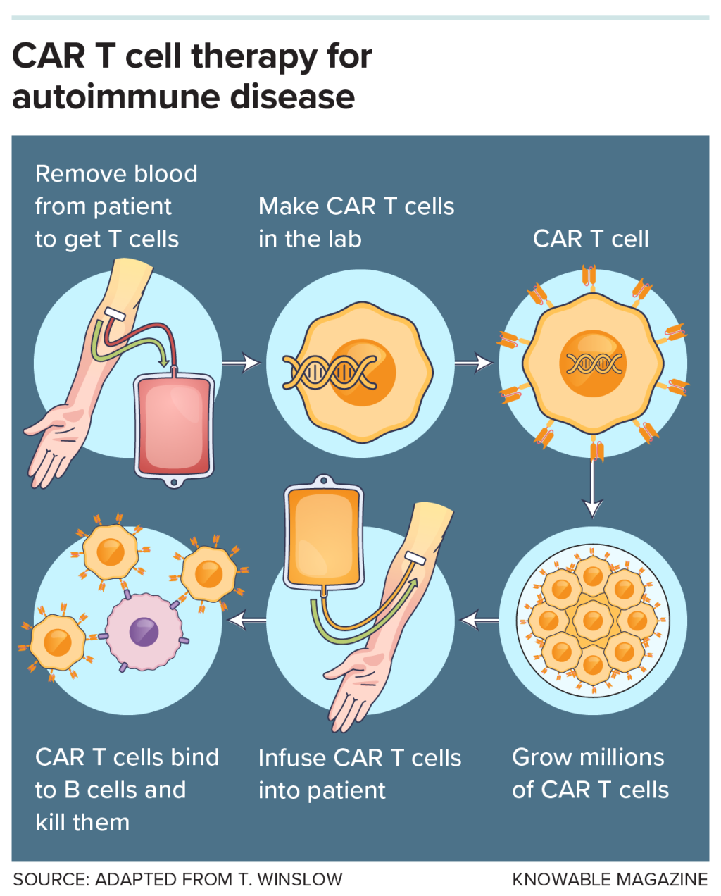 Graphic showing one of the many variations on CAR T procedures with the basic process involving removing, modifying and re-infusing patient T cells so they can attack their target, which is B cells in the case of autoimmune disease.