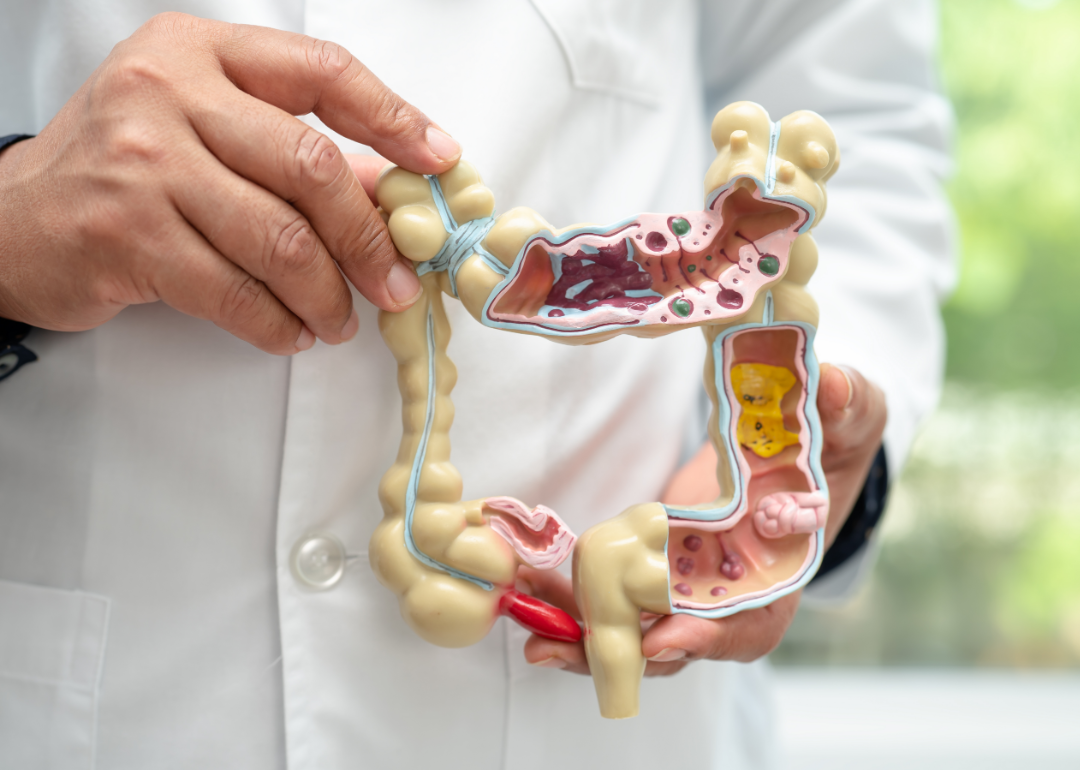 A medical professional in a white lab coat holding a model of an intestine.