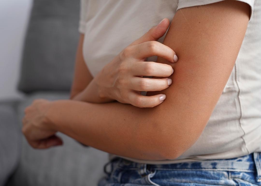 Close-up of person scratching their arm with their nails.